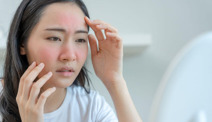 Woman looking at red, irritated skin in mirror